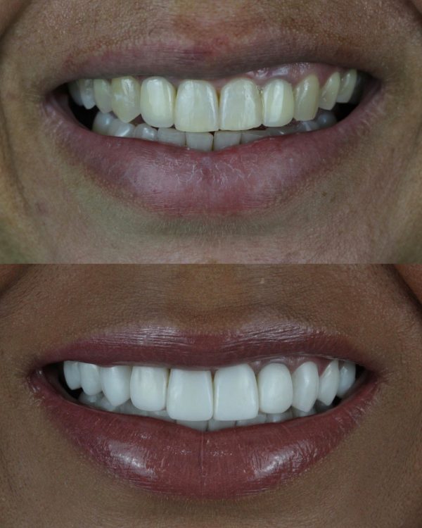 45356F18-49F0-45C1-80B6-E9483FFCBAF3