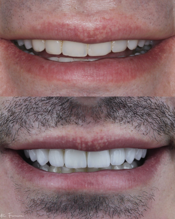 75DB1BD1-6950-4F80-A7D4-371C2CB7712B